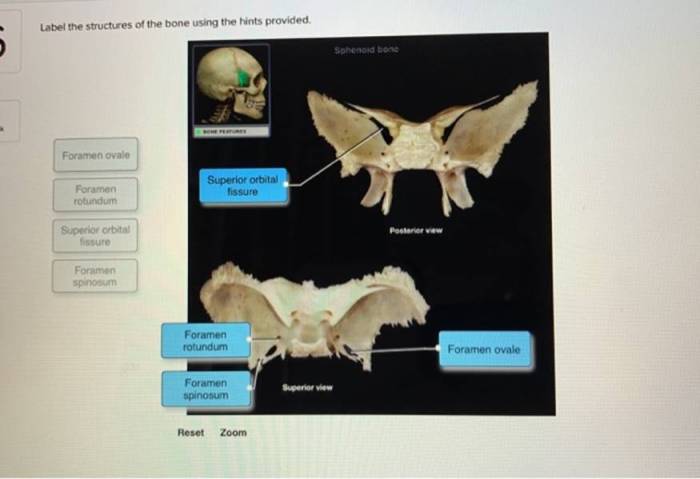 Label the male perineum using the hints provided.