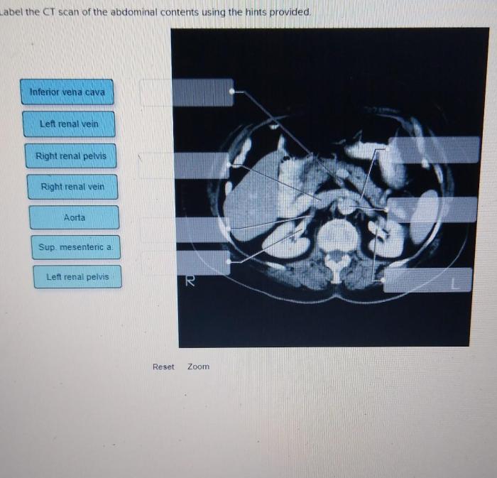 Photomicrograph hints transcription gland suprarenal